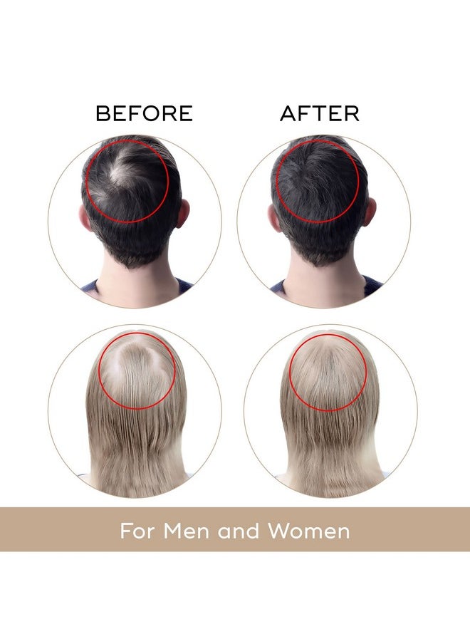 Charismo - Usa Dekohair Hair Regrowth Serum Complete Hair Regrowth Solution Facilitates Hair Growth And Prevents Hair Thinning Stops Hair Loss And Increases Root Volume - Image 1