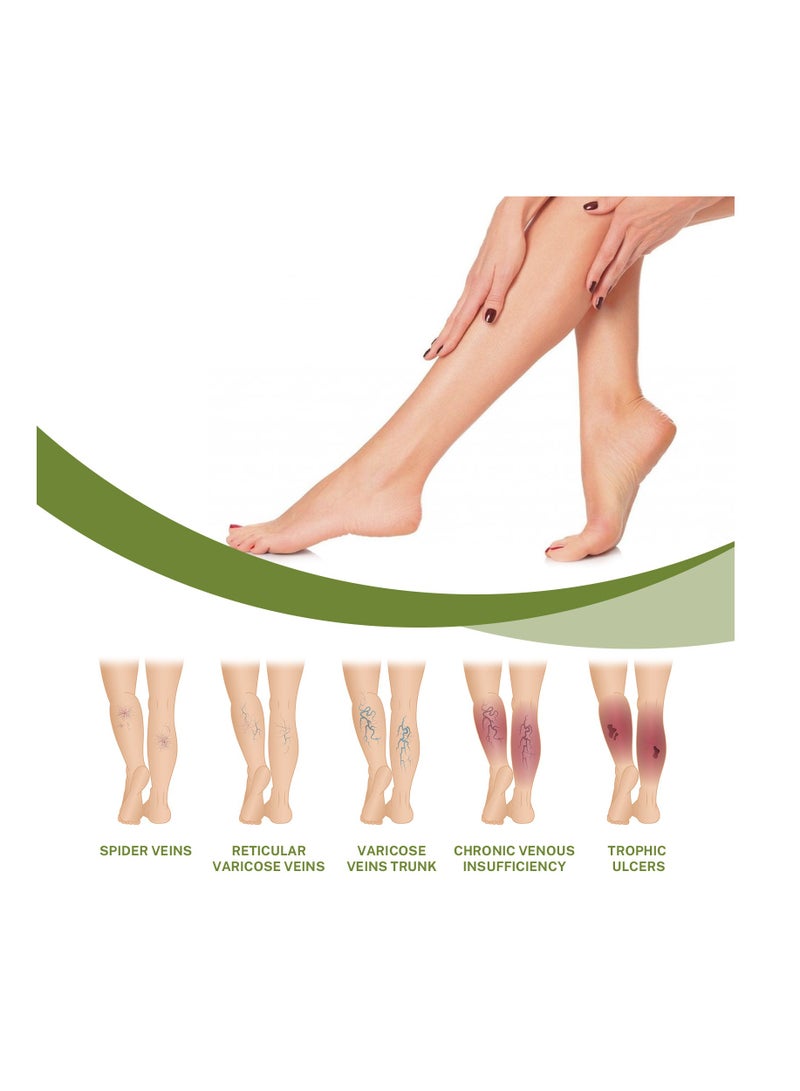 EELHOE Varicose Vein Repair Cream Suitable for Relieving Pain and Clearing Leg Meridians - Image 4