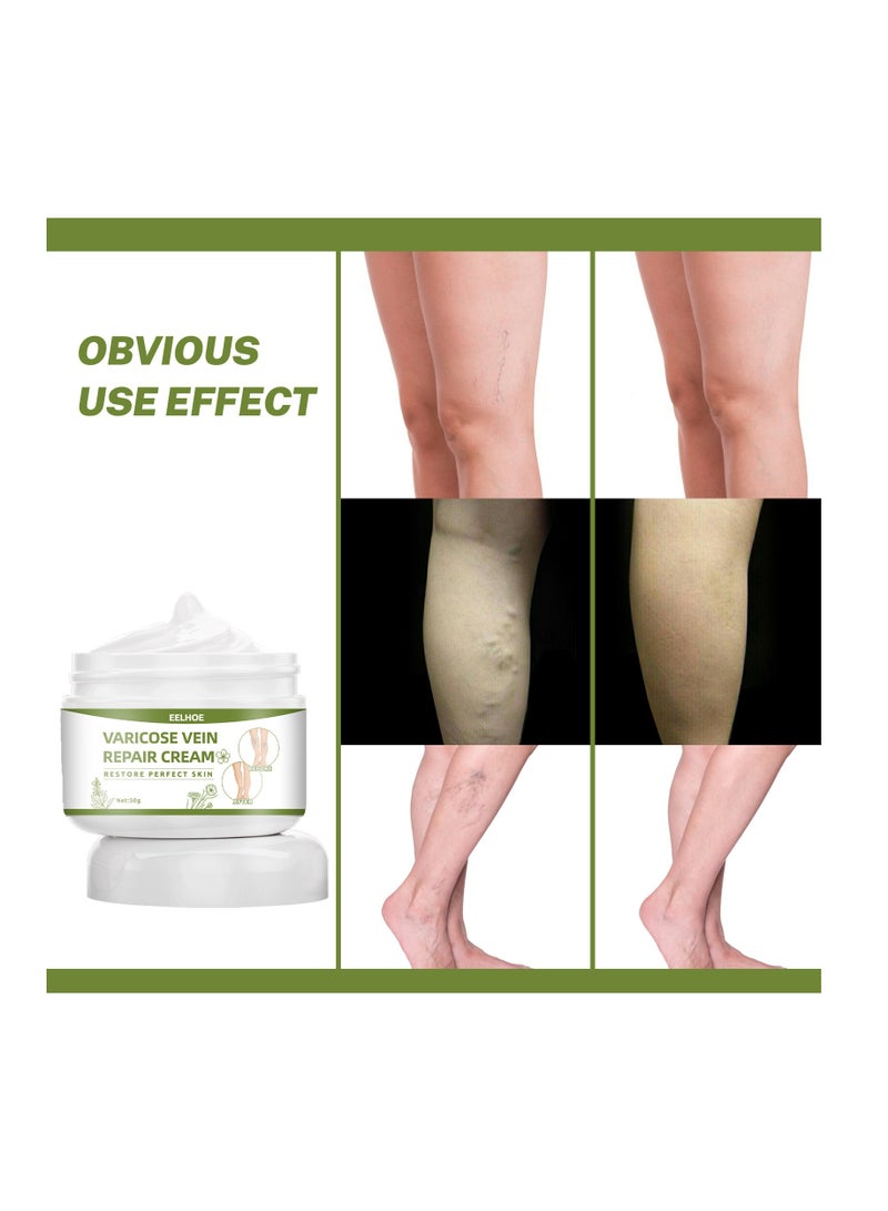 EELHOE Varicose Vein Repair Cream Suitable for Relieving Pain and Clearing Leg Meridians - Image 5