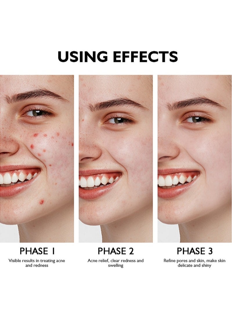 lakerain - 10% Azelaic Acid Booster - Treatment Reduces Pigment Spots, Pimples and Blemished Skin - with Azelaic Acid and Salicylic Acid - All Skin Types - 30 ml - Image 1