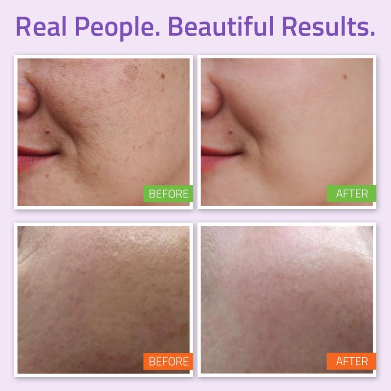 YEOUTH Skin Care Set: Hyaluronic Acid Serum, Vitamin C Serum, Face Cleanser, Toner, Under Eye Gel, Face Cream, 6-Piece Skincare Kit For Women & Men - Image 3