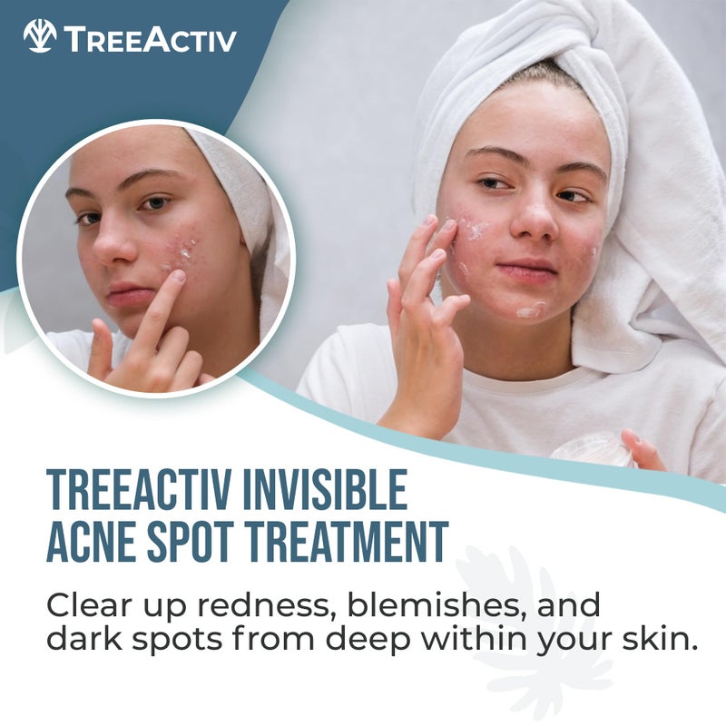 TreeActiv Invisible Acne Spot Cream 150+ Uses, Salicylic Acid & Tea Tree Oil Clear-Drying Formula for Acne-Prone Skin, Works on Blackheads & Whiteheads - Image 2