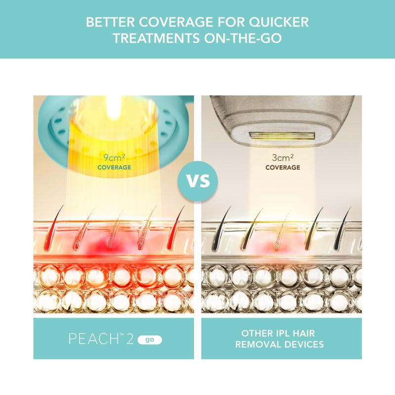 FOREO Peach 2 go IPL Hair Removal Device - Travel-Friendly Permanent Hair Removal - Laser Hair Removal - Body & Face - Painless Hair Removal - Skin Cooling & Silicone Shield - Customizable Artic Blue - Image 3