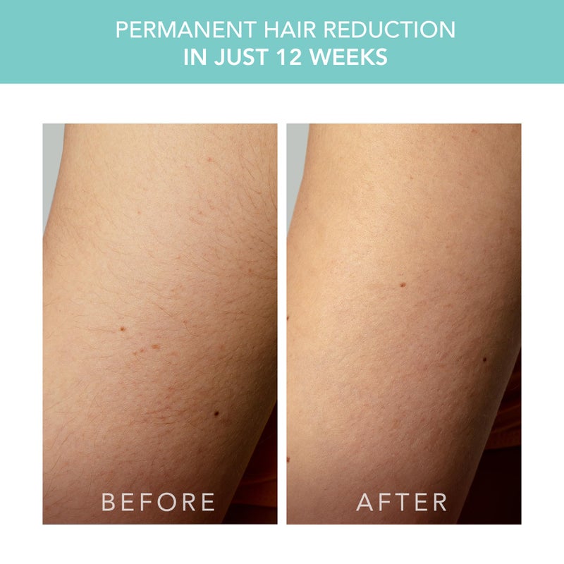 FOREO Peach 2 go IPL Hair Removal Device - Travel-Friendly Permanent Hair Removal - Laser Hair Removal - Body & Face - Painless Hair Removal - Skin Cooling & Silicone Shield - Customizable Artic Blue - Image 5