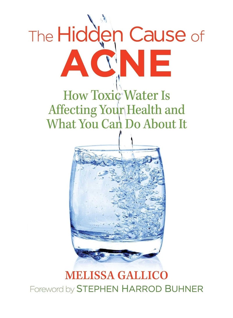 The Hidden Cause of Acne  How Toxic Water Is Affecting Your Health and What You Can Do about It (2ND) 