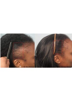 Infinix Black Seed Oil for powerful Hair growth - Thick and Full  - Image 3