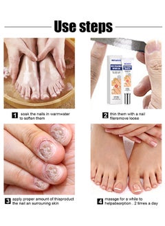 Nail Treatment Repair Gel - Nail Repairing Gel Eliminates Of Fungus And Bacterial - Nail Growth Care To Restore The Look Of Discolored Or Damaged Nails 20G - pzsku/ZE024C662A2D91F67466EZ/45/_/1694756804/fbcf31ab-59b8-4e96-801e-2504c751462e