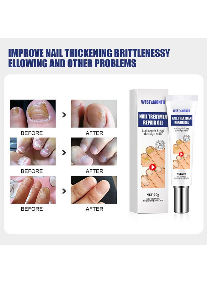 West&Month Nail Treatment Repair Gel - Nail Repairing Gel Eliminates Of Fungus And Bacterial - Nail Growth Care To Restore The Look Of Discolored Or Damaged Nails 20G  - Image 4