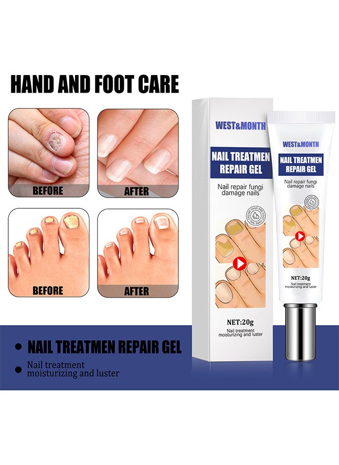 West&Month Nail Treatment Repair Gel - Nail Repairing Gel Eliminates Of Fungus And Bacterial - Nail Growth Care To Restore The Look Of Discolored Or Damaged Nails 20G  - Image 2