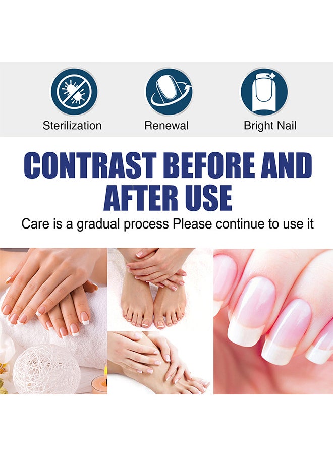 West&Month Nail Treatment Repair Gel - Nail Repairing Gel Eliminates Of Fungus And Bacterial - Nail Growth Care To Restore The Look Of Discolored Or Damaged Nails 20G  - Image 5