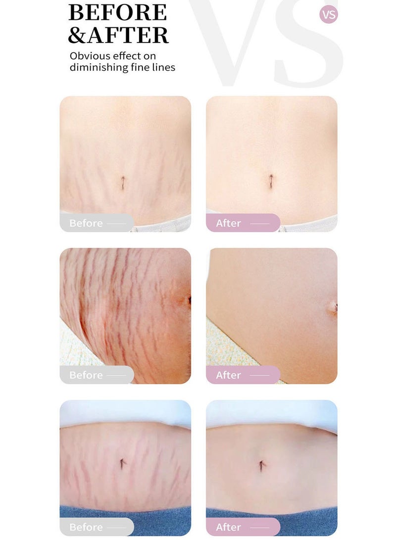 RtopR Mango Stretch Mark Massage Cream Pregnancy Scars  For Maternity Repair Stretch Marks Enhance Skin Elasticity, Can Promote Cell Regeneration, Smooth Skin, Designed For Mother's Stretch Marks Fast Absorbing - Image 4