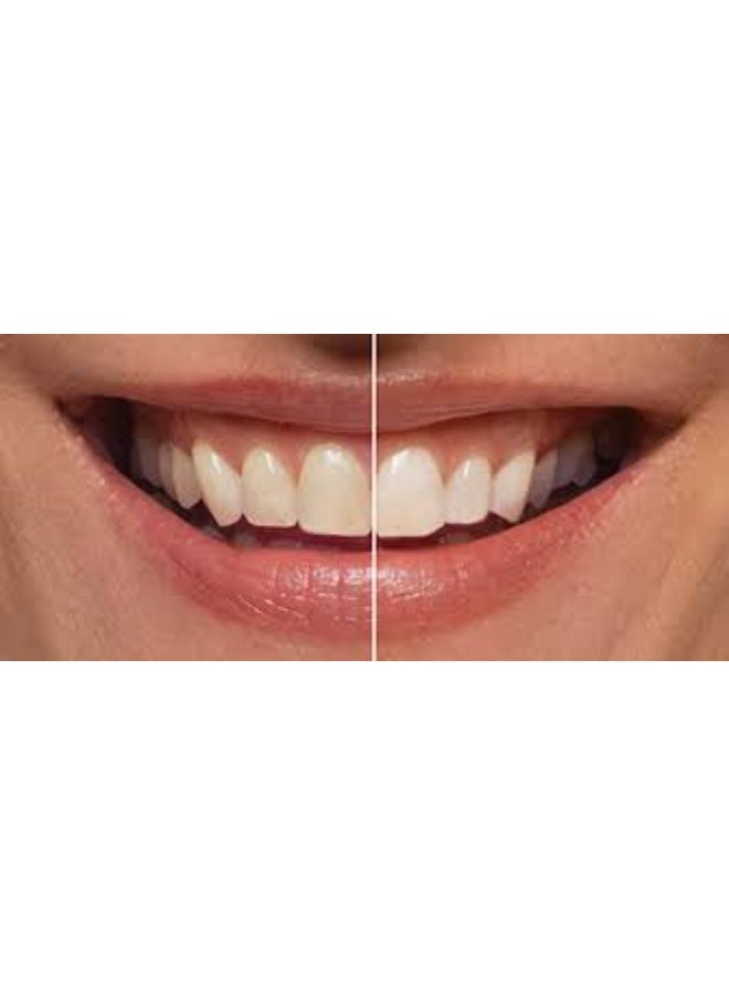 LEBON Electric toothbrush Urban Blue 1 piece - Image 3