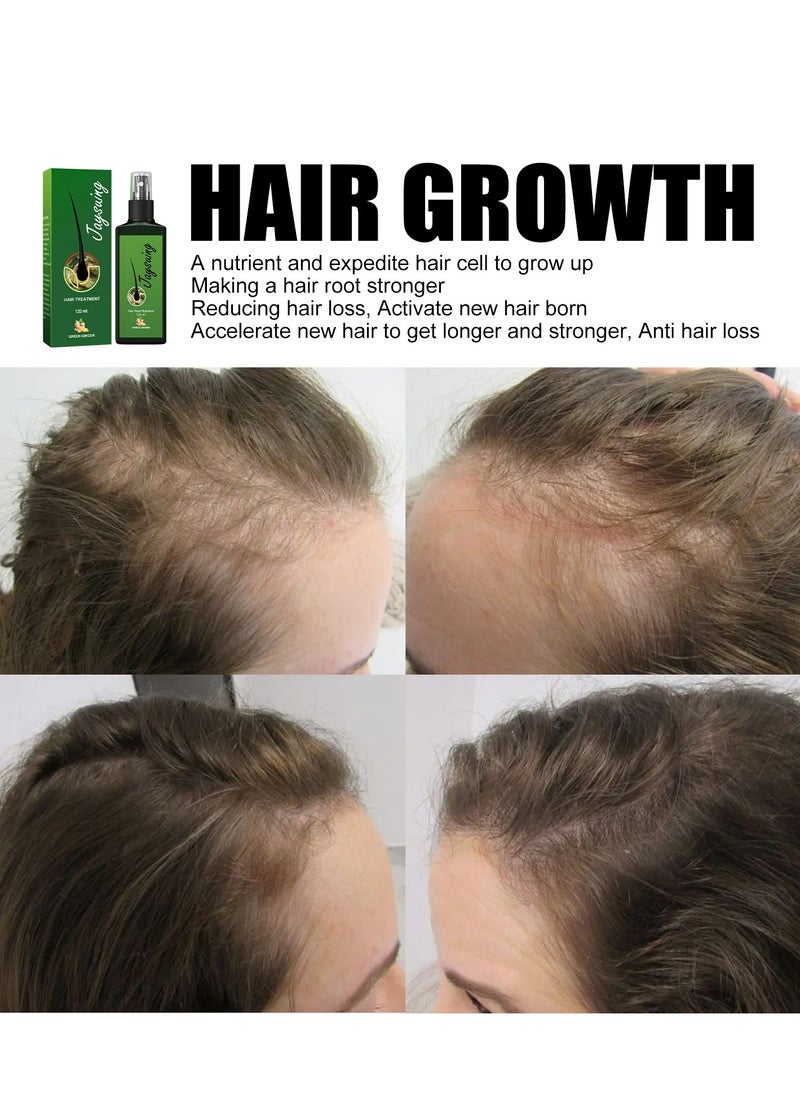 Jaysuing - Strengthening hair nourishing hair root growth thickening scalp massage nutritional solution 30ml - Image 1