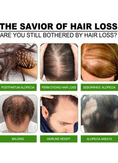 Jaysuing Strengthening hair nourishing hair root growth thickening scalp massage nutritional solution 30ml  - Image 3