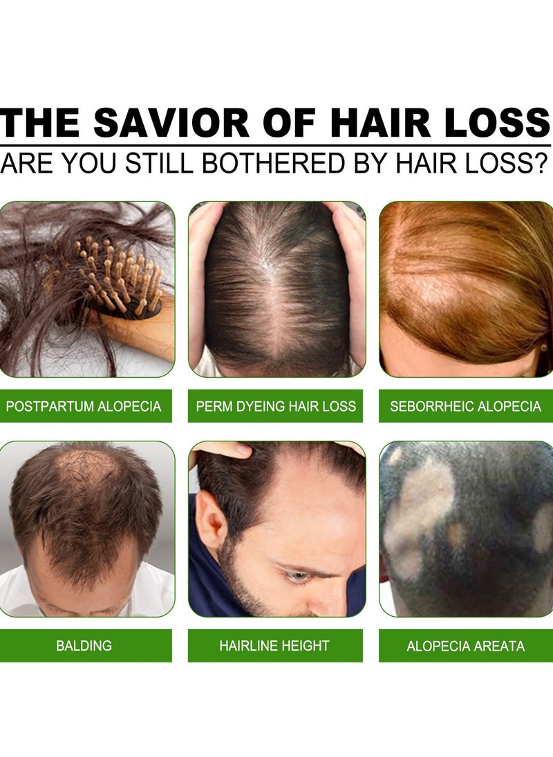 Jaysuing - Strengthening hair nourishing hair root growth thickening scalp massage nutritional solution 30ml - Image 1