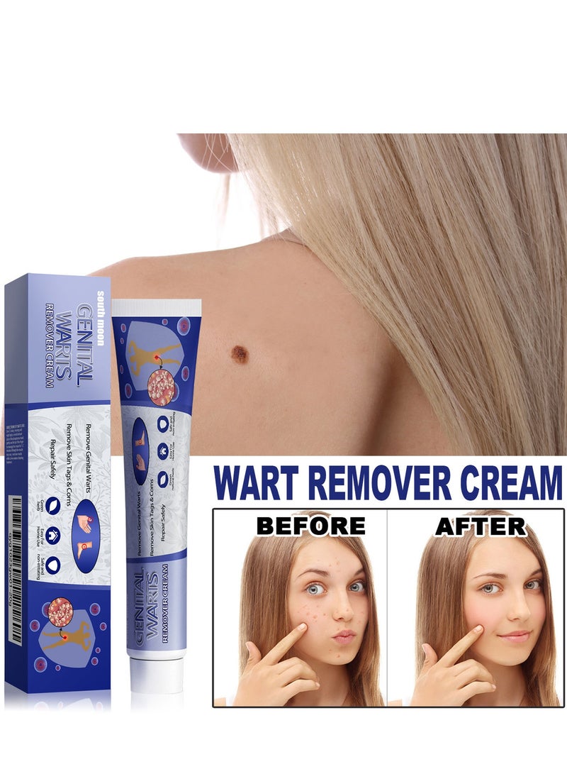 SOUTH MOON Skin Tag & Wart Remover Gel - Fast Acting Freeze Off Formula for Common Warts, Plantar Warts on Feet, Hands & Skin | Pain-Free Removal  - Image 1