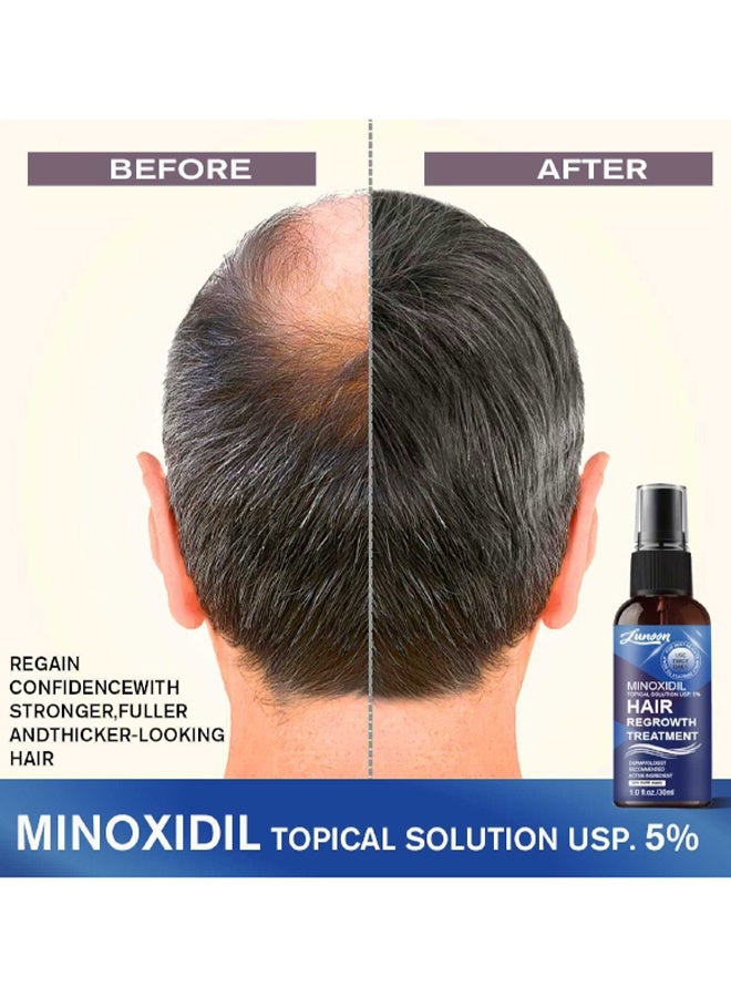 LUNOON Minoxidil Hair Regrowth Treatment - 5% Minoxidil for Men and Women Hair Growth - for Men to Regrow Fuller, Thicker Hair u0026 Beard - Minoxidil for Women Hair Growth- Improves Appearance of Thinning Hair - Image 4