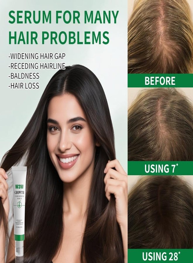 W3W Hair Growth Serum for Scalp - Hair Serum for Hair Growth Accelerates, Strengthens & Thickens Hair Nourishing Formula with Caffeine Non-Greasy Hair Regrowth Treatment Prevents Hair Loss & Thinning - Image 3