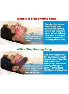 Generic Snoring Chin Strap Snoring Chin Strap Comfortable Universal Anti Snoring Devices Adjustable Effective Stop Snoring Sleep Aid Snore Reducing Aid for Women & Men  - Image 5