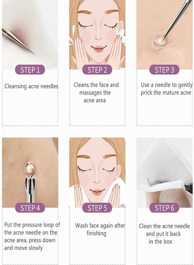 Scheibe Stainless Steel Blackhead Remover Needle, Pack Of 1 - Image 4