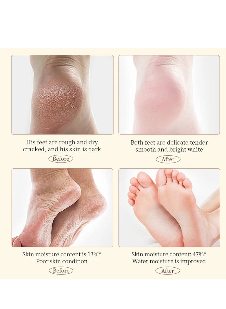 SADOER SADOER Shea Butter Anti Cracking Hand Foot Cream 60g  - Image 5