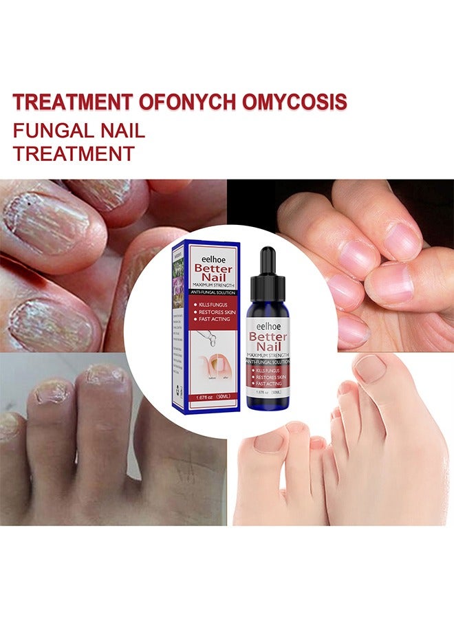 إيلهو إصلاح علاج الأظافر ، سائل إصلاح الأظافر ، يكون إصبع أخمص القدمين صحة سائلًا للجمال لرعاية نمو الأظافر يستعيد ظهور الأظافر المشوهة أو التالفة 50 مل - Image 3