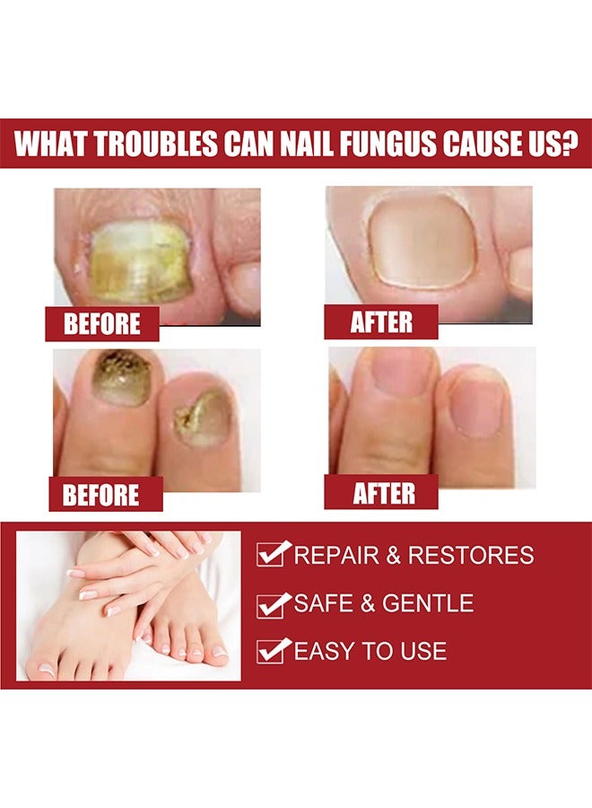 إيلهو إصلاح علاج الأظافر ، سائل إصلاح الأظافر ، يكون إصبع أخمص القدمين صحة سائلًا للجمال لرعاية نمو الأظافر يستعيد ظهور الأظافر المشوهة أو التالفة 50 مل - Image 5