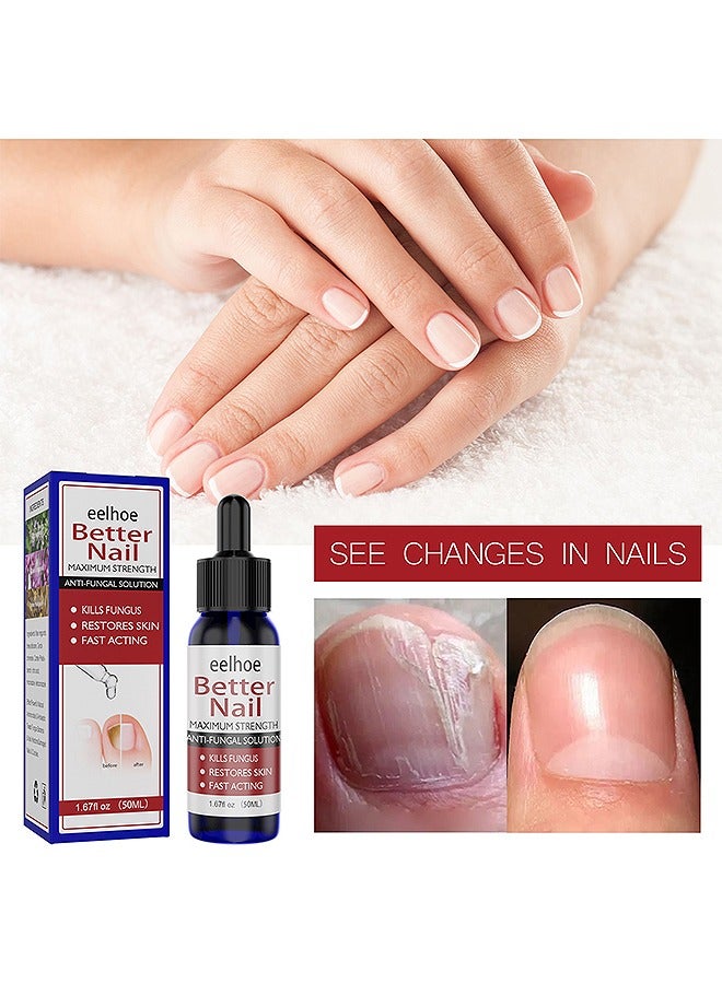 إيلهو إصلاح علاج الأظافر ، سائل إصلاح الأظافر ، يكون إصبع أخمص القدمين صحة سائلًا للجمال لرعاية نمو الأظافر يستعيد ظهور الأظافر المشوهة أو التالفة 50 مل - Image 1