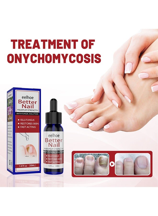 إيلهو إصلاح علاج الأظافر ، سائل إصلاح الأظافر ، يكون إصبع أخمص القدمين صحة سائلًا للجمال لرعاية نمو الأظافر يستعيد ظهور الأظافر المشوهة أو التالفة 50 مل - Image 2