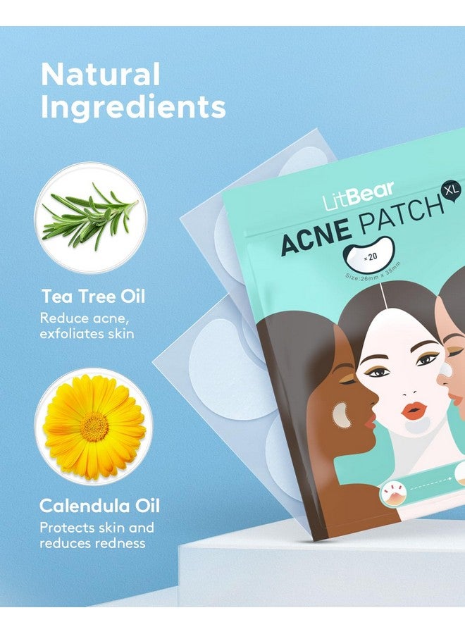 LitBear LitBear Acne Patches Large, Hydrocolloid Pimple Patches for Large Breakouts, Zit and Blemish, Large Acne Patches for Face, Chin, Back and Body with Tea Tree & Calendula Oil  - Image 5