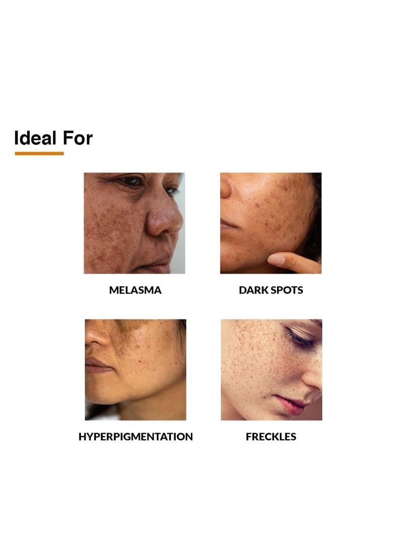 Fixderma Skarfix-Plus Scar Removal Cream | Hyperpigmentation Removal Cream and Acne Scars Removal Cream | Helps to Reduce Melasma- 15 g - Image 2