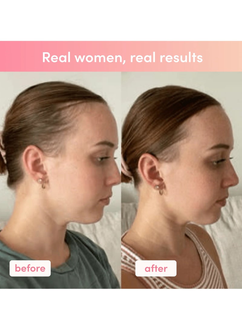 شركة الكولاجين ساشيهات كولاجين بنكهة الفراولة والبطيخ - 280 جرام - Image 4