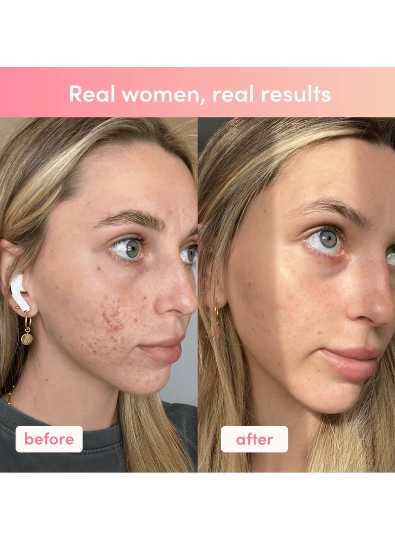 شركة الكولاجين ساشيهات كولاجين بنكهة الفراولة والبطيخ - 280 جرام - Image 5