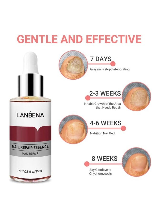 LANBENA LANBENA Nails Repair, Nail Treatment Nail Care Serum Protect Nail from Damage Fingernail and Toenail Repair for Curing Athlete's Foot and Prevent Nail from Infection Discolored & Damaged Nails 15ml  - Image 3