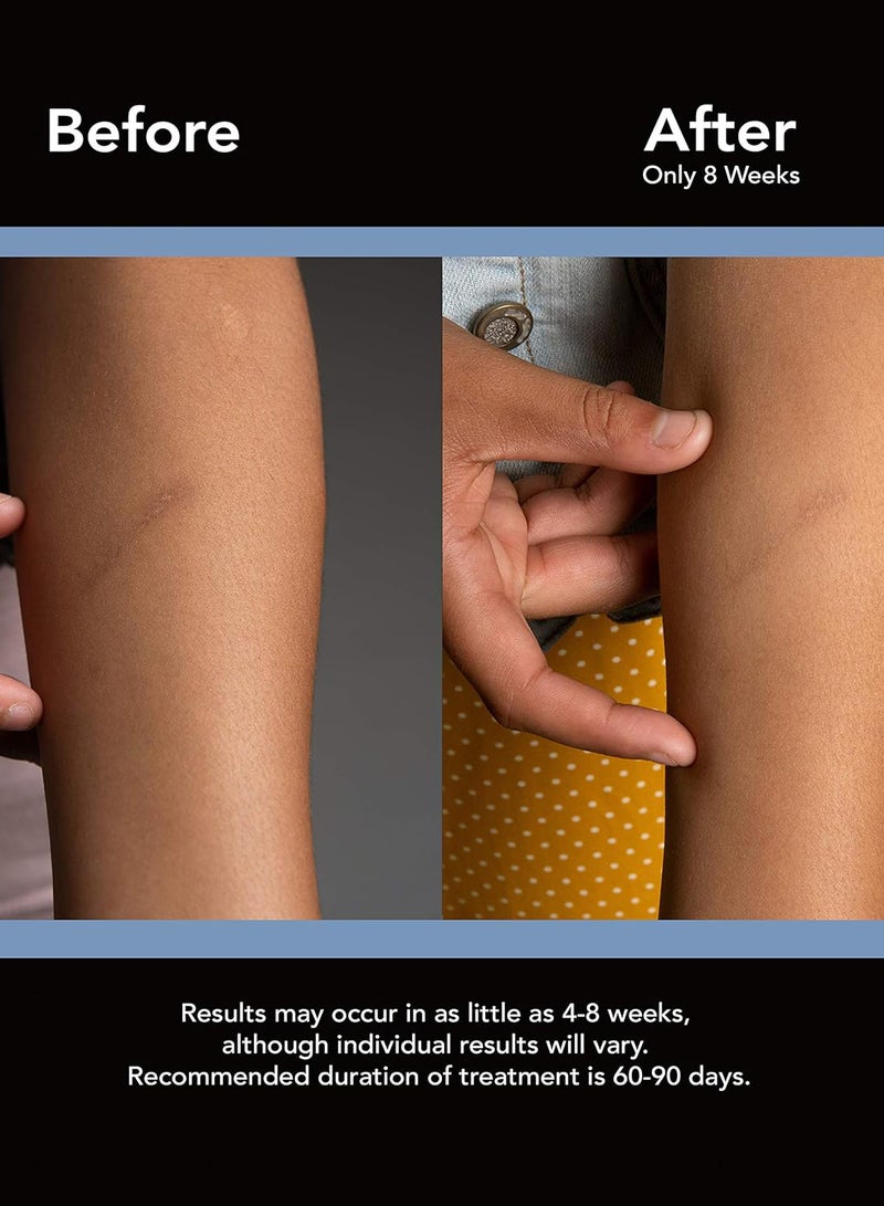 scaraway Professional Grade Silicone Scar Treatment Sheets 1.5 X 3 8Count - Image 3