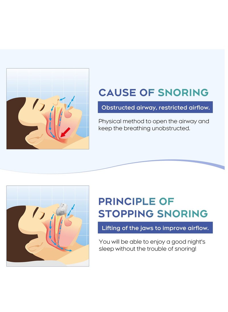 XiuWoo Anti Snoring Devices, Effective Snoring Prevention, Twin Turbine Electric Adjustable and Breathable, Adjustable Wind Speed, Snoring Solution for Men and Women, Suitable for All Nose Shapes, White - Image 5