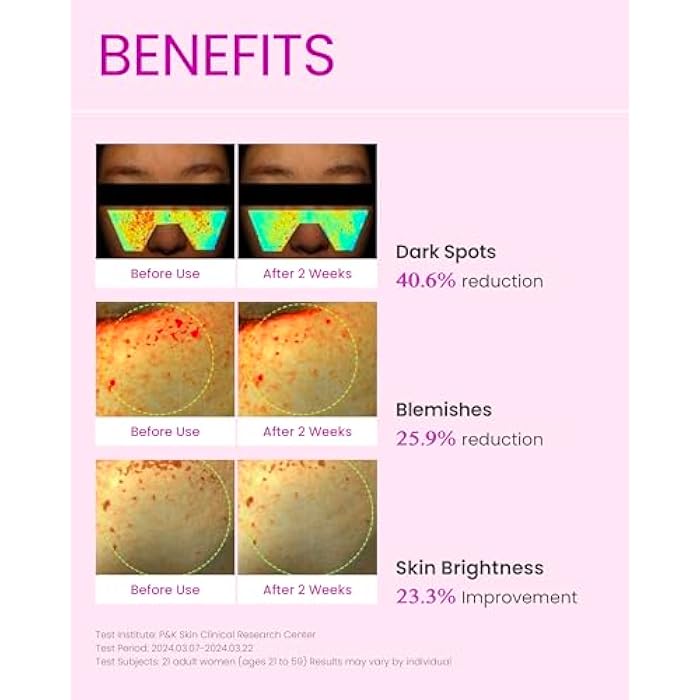 DOMINAS AtClinic DOMINAS Tranexamic Acid Pink Serum (1fl oz) - Improve Skin Tone and Hyperpigmentation, Ampoule for All Skin Types. Korean Skin Care. Niacinamide - Image 3