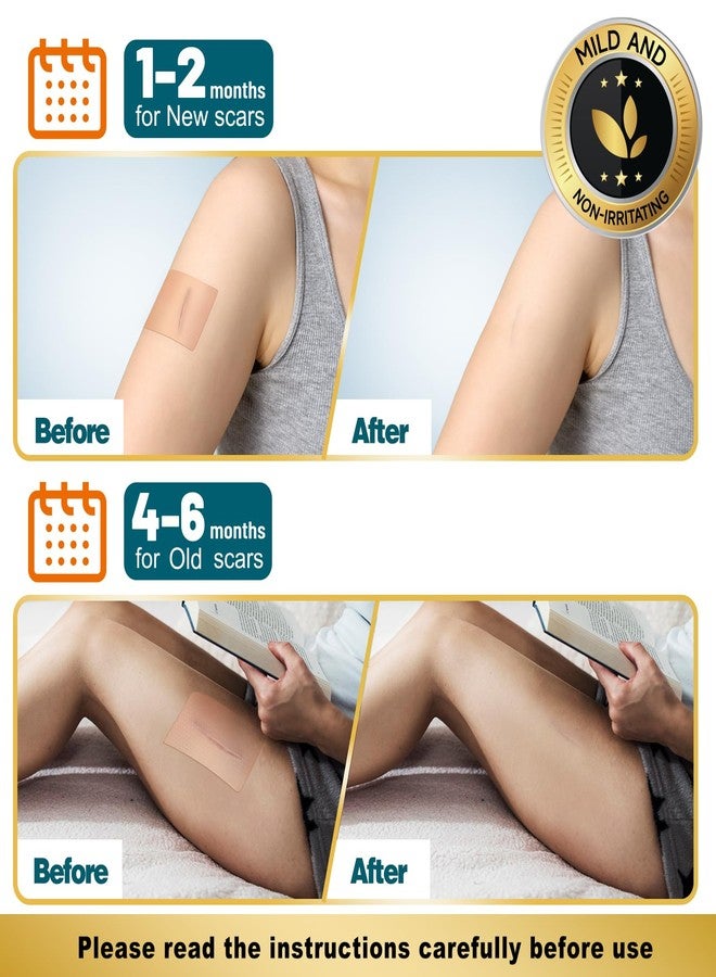 Arme Silicone Scar Tape, 1.6"x480" Silicone Scar Sheets(4 Rolls-12M) Medical Grade Scar Tape for Surgical Scars, Reusable Scar Patches, Professional Scar Removal Strips for C-Section Keloid Tummy Tuck - Image 5