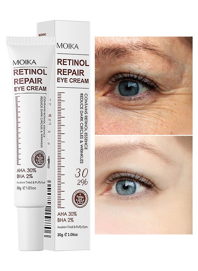 MOIKA - Retinol Repair Eye Cream, For Dark Circles And Puffiness, With AHA And BHA Dark Circle Fine Lines Treatment, Anti-Aging, Under Eye Treatment, Reduces Wrinkles, Defoams And Brightens Skin 30G - Image 1
