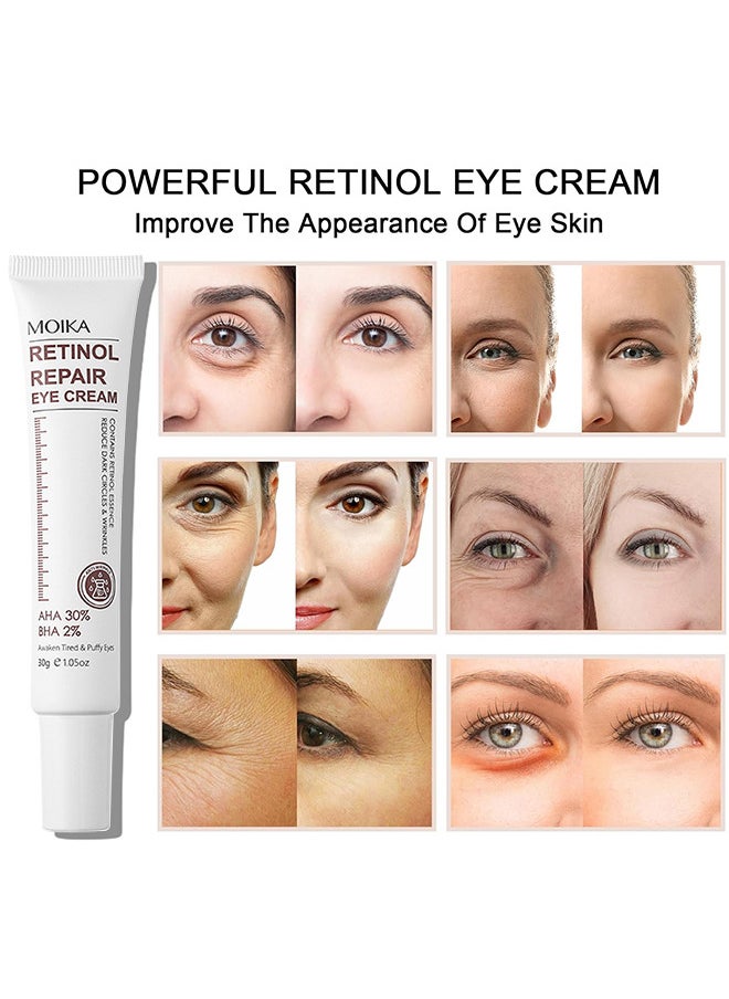 MOIKA - Retinol Repair Eye Cream, For Dark Circles And Puffiness, With AHA And BHA Dark Circle Fine Lines Treatment, Anti-Aging, Under Eye Treatment, Reduces Wrinkles, Defoams And Brightens Skin 30G - Image 1
