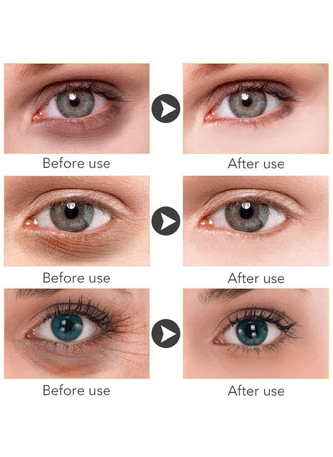 MOIKA - Retinol Repair Eye Cream, For Dark Circles And Puffiness, With AHA And BHA Dark Circle Fine Lines Treatment, Anti-Aging, Under Eye Treatment, Reduces Wrinkles, Defoams And Brightens Skin 30G - Image 1