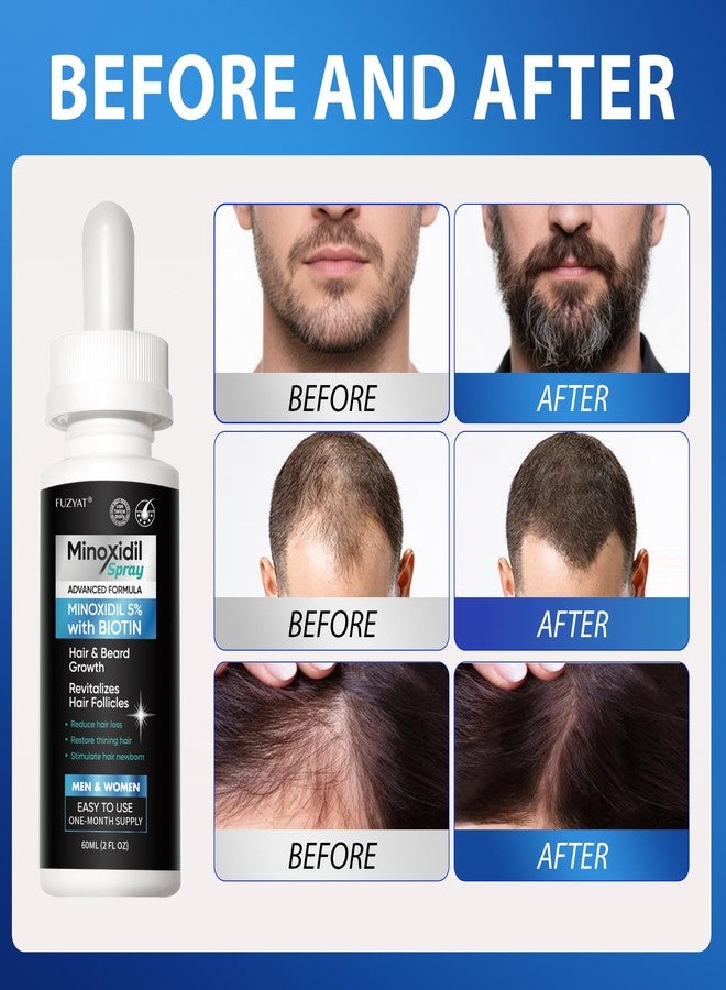 FUZYAT 5% Minoxidil Hair Regrowth Treatment Serum for Men and Women, Biotin & Castor Oil Enriched Hair Regrowth Treatment, Strengthens Weak Roots, Repairs Thinning Hair, 60ml x 2pcs - Image 4