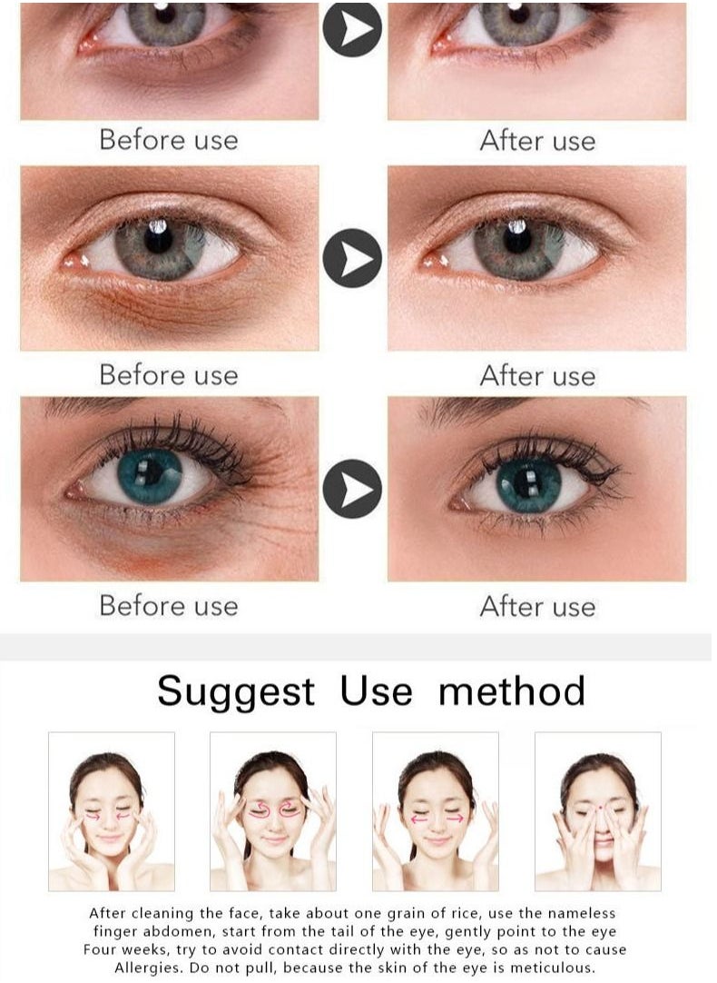 Water Ice Levin - Retinol Cream Anti Aging Moisturizer Face Cream 2.5% Active Retinol Hyaluronic Acid Collagen Anti Wrinkle Facial Cream - Image 1