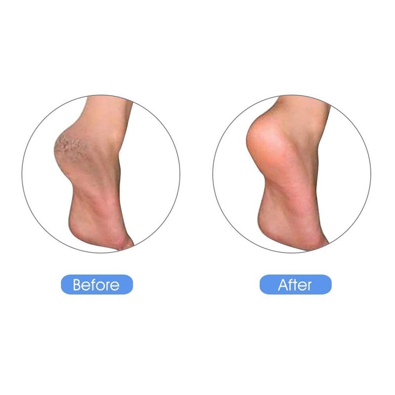 KuuCare حجر الخفاف من كوكير للقدمين، حجر الخفاف الطبيعي من الأرض البركانية - أداة إزالة الكالو للقدمين والكعب، مقشر باديكير للجلد الميت، الجلد الصلب وفرك القدمين - Image 5