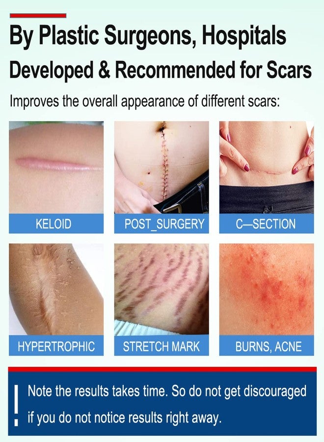 MINGYITUO Silicone Scar Sheets Tape for Surgical Scars, C Section Scar Silicone Strips, Medical Grade, Reusable, Soften and Flattens Scars, Breast, Keloid, Professional Scar Patches. (1.8x157 Inch) - Image 2