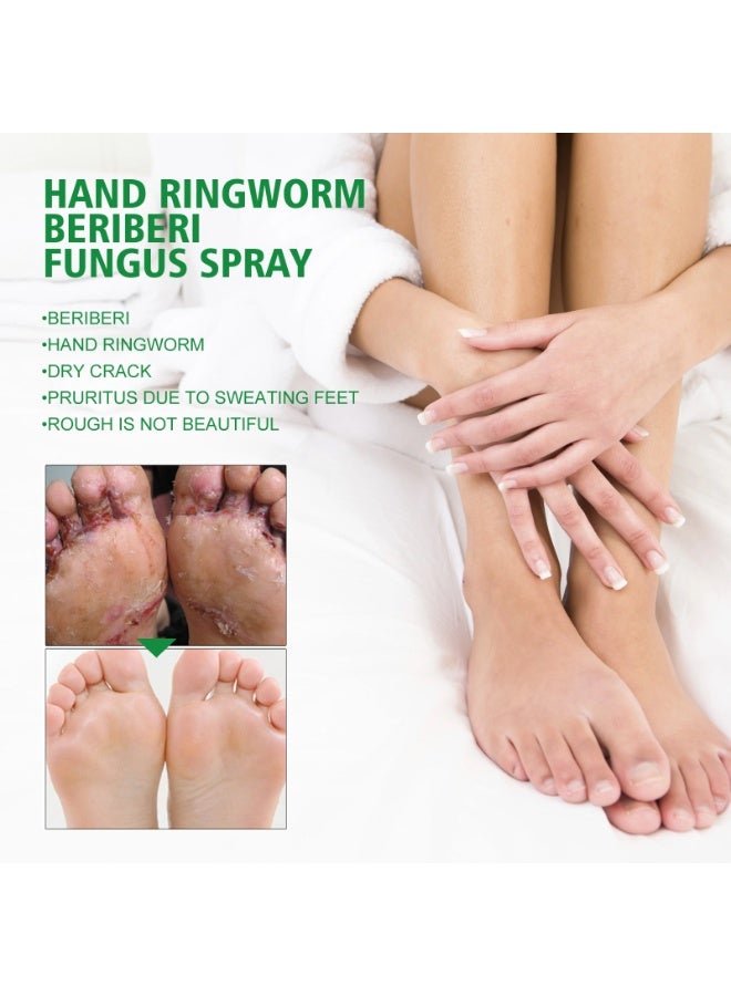 SOUTH MOON Hand Foot Care Medicine Gentle Formula Antifungal Spray Hand Ringworm Beriberi Fungus Spray 30ML - Image 5
