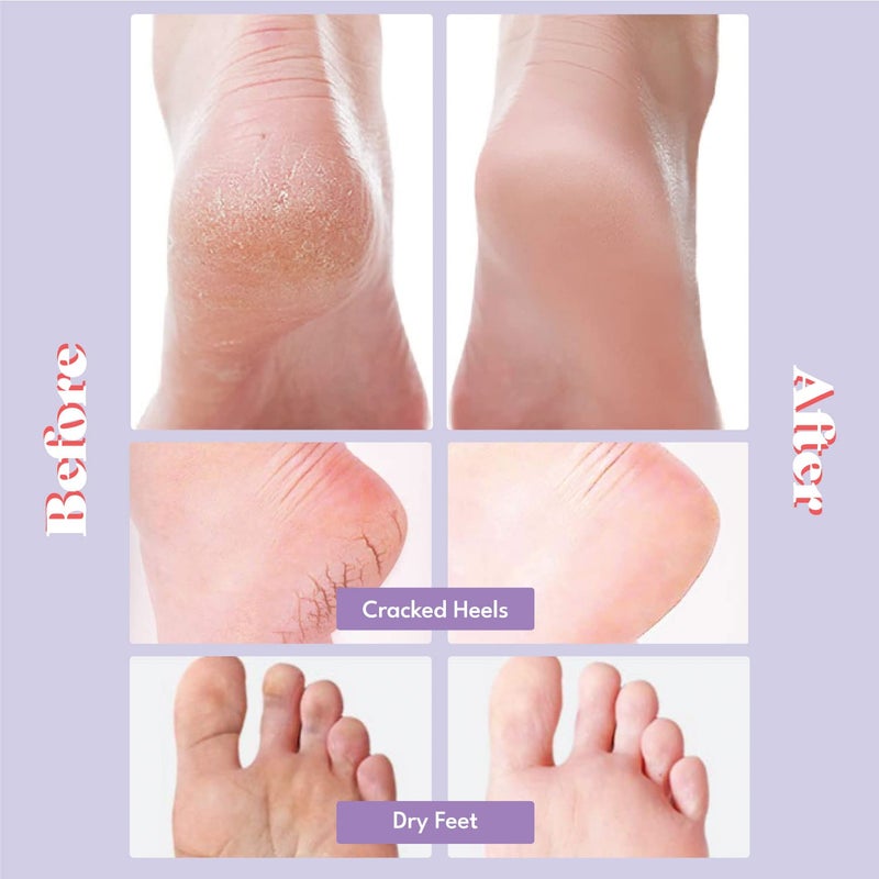 Toi:L Extra Silky Foot Mask 5 Pairs, Post-Peeling Foot Care Treatment, Moisturizing Socks with Guerande Salt & Sweet Almond Oil for Dry Feet, Cracked Heels, and Callus, Stocking Stuffer - Image 2
