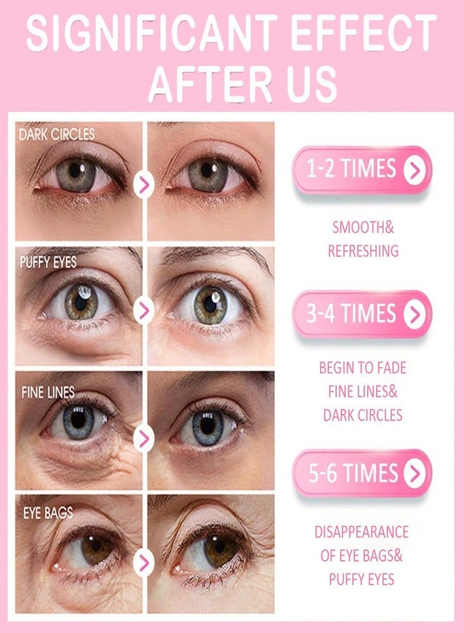 ZARICS 30 Pairs Lip Mask & Eye Mask, Hangover Kit, Hangover Patches, Under Eye Patches, Anti Wrinkle Patches for Lip, Reducing Dark Circles, Bulk Gifts for Women, Girl Stuff, Bachelorette Party Favors - Image 4