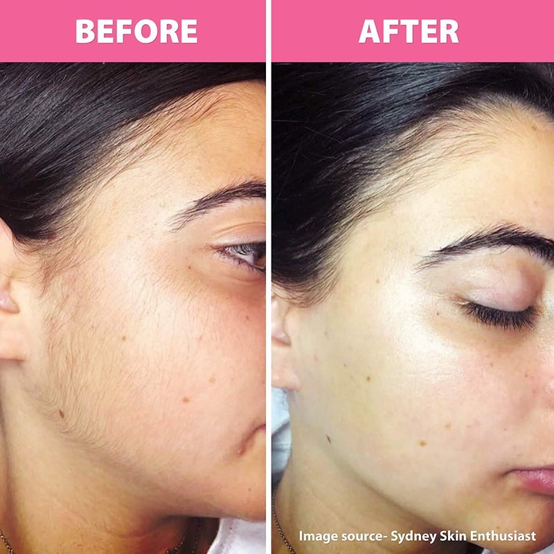 TOP SELECT Eyebrow Painless Facial Hair Remover Razor for Face, Women and Men (Multicolour) (Pack of 2) - Image 2