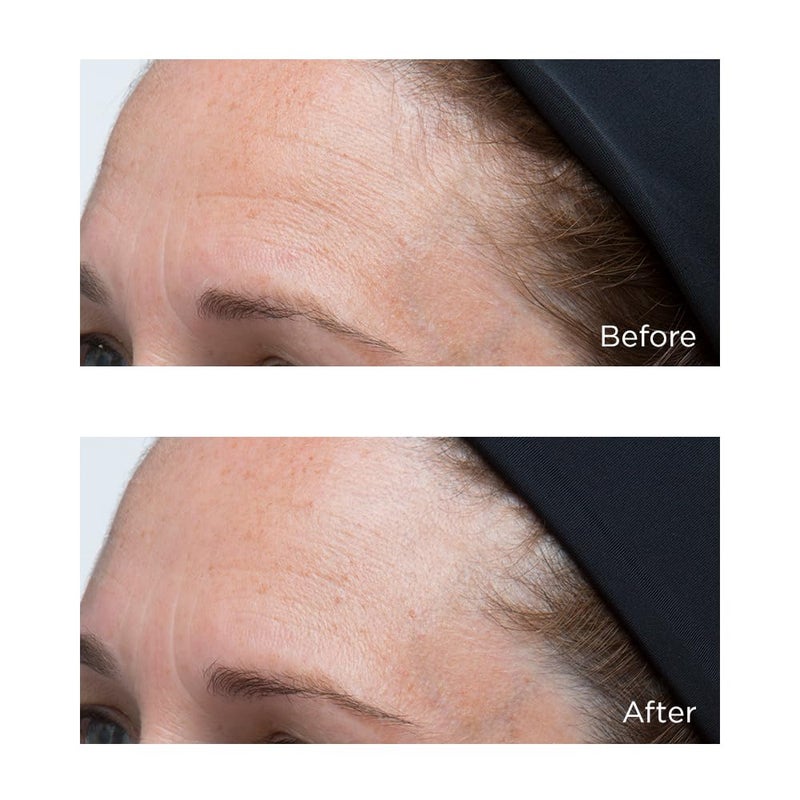 Perricone MD High Potency Classics: Hyaluronic Intensive Moisturizer 1 Fl Oz (Pack of 1) - Image 4